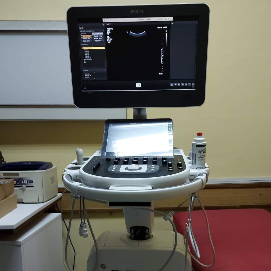 Нови ултразвучни апарат за радиологију