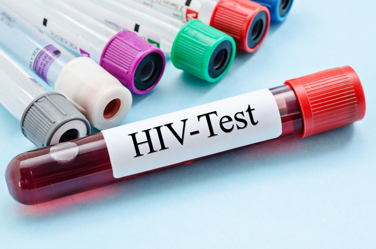 Завод за јавно здравље: Тестирање на ХИВ