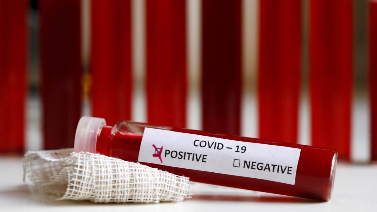 У Србији још 254 позитивна на корона вирус, на респираторима 87