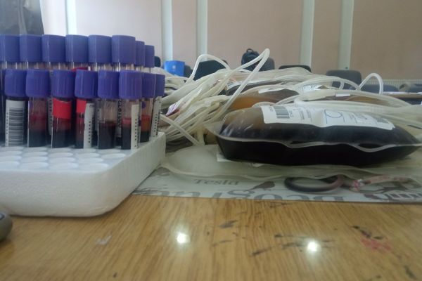 ITK Srbije: Smanjene rezerve krvi