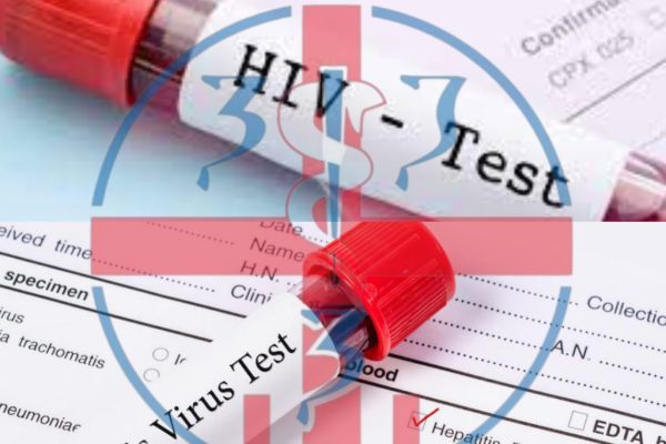 ZZJZŠ: Besplatno testiranje na Hiv, Hepatitis B i C i sifilis